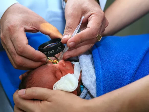 Prematüre Retinopatisinde Göz Muayenesi