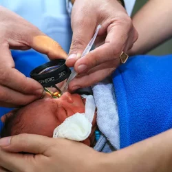 Prematüre Retinopatisinde Göz Muayenesi